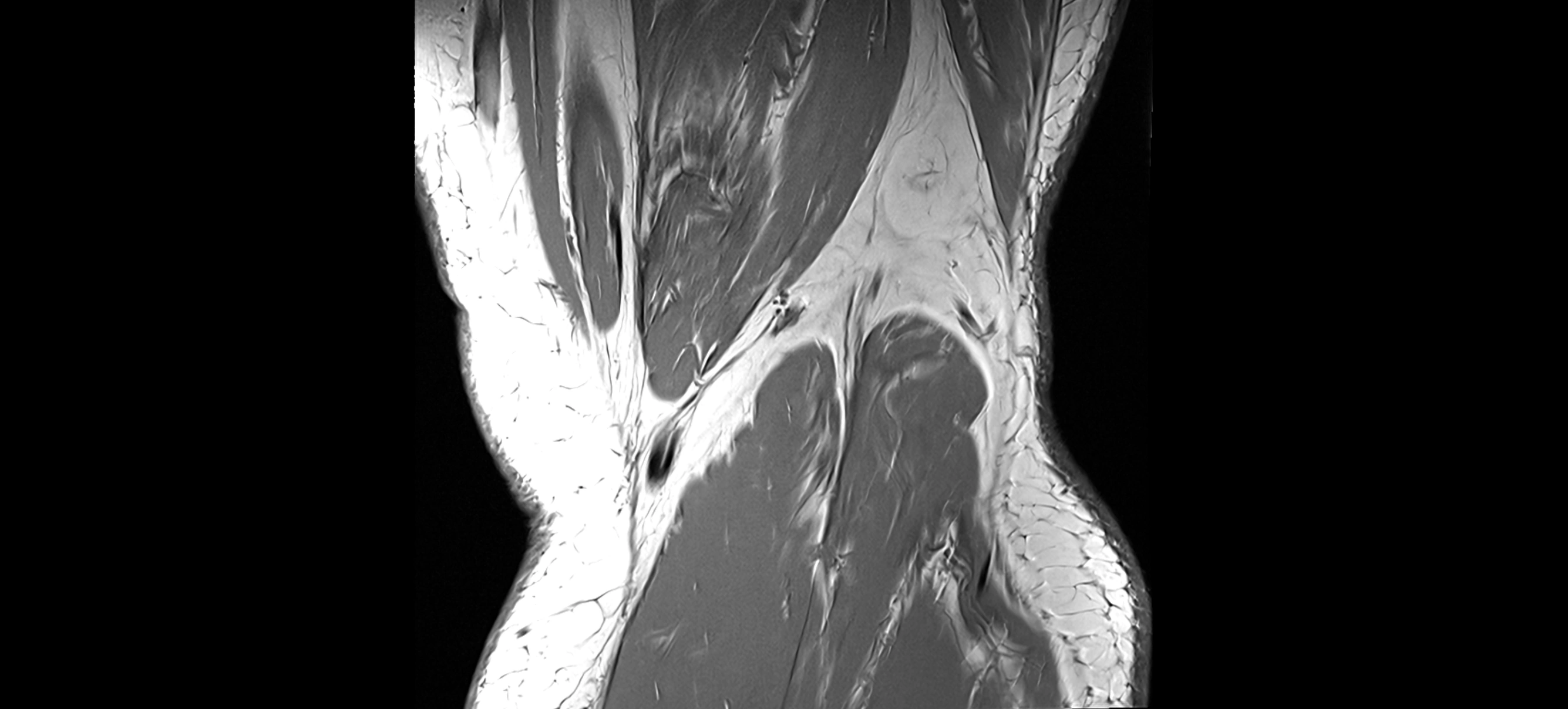 MRI coronal  ligaments cross sectional anatomy 3T  radiology  image-img-04001-00039.webp